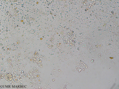 phyto/Pertuis Charentais/Tasdon_st2/PAMPAS 2019-2021/Tetraedron caudatum var. longispinum (TASDON_St2_r1_0419003).tif(copy)_thumb.jpg